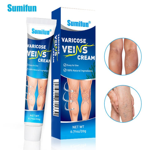 Sumifun Varicose Vein Relief Cream 20g | Buy 1 Take 2