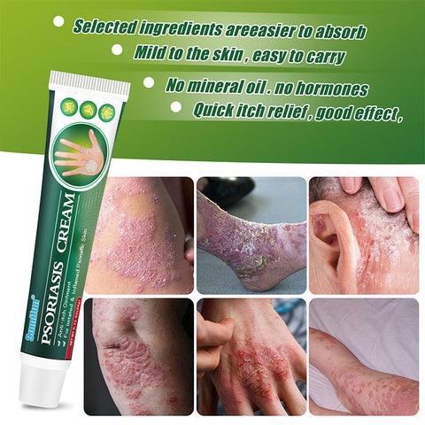 Sumifun Psoriasis Relief Cream 20g FDA Approved | Buy 1 Take 2