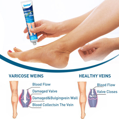 Sumifun Varicose Vein Relief Cream 20g | Buy 1 Take 2
