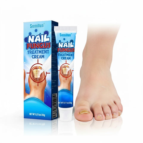 Sumifun Nail Fungus Treatment Cream 20g | Buy 1 Take 2