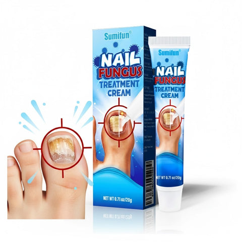Sumifun Nail Fungus Treatment Cream 20g | Buy 1 Take 2