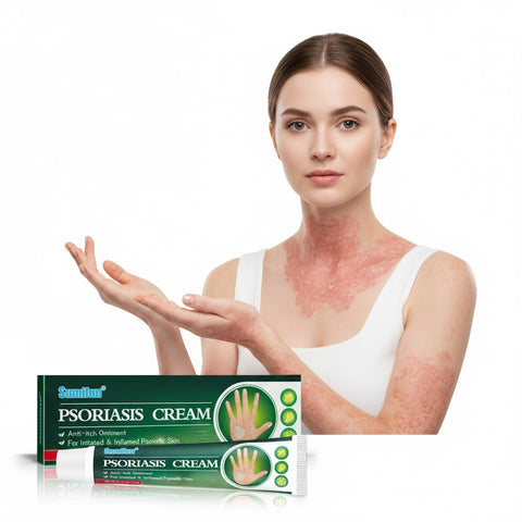 Sumifun Psoriasis Relief Cream 20g FDA Approved | Buy 1 Take 2