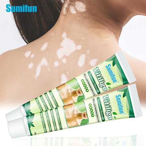 BIGMK.PH Regular SumifunWhite Spot VitiligoTreament Cream Antibacterial Cream Psoriasis Localized Vitiligo Ointment Mycosis Leukoplakia Treatment